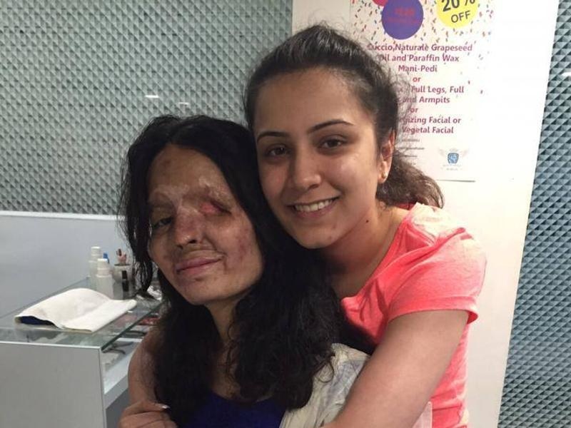 co gai An do bi tat axit anh 8