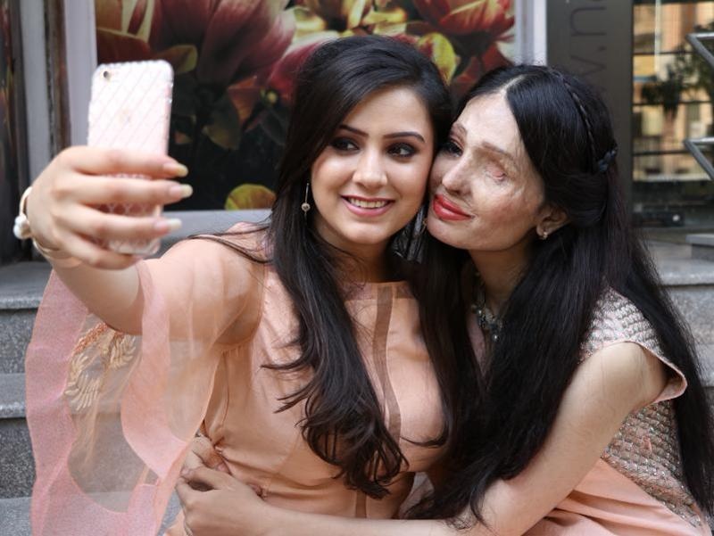 co gai An do bi tat axit anh 9