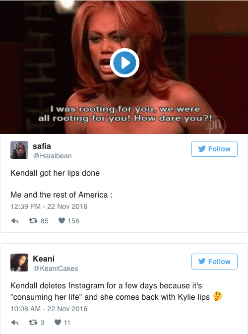 Kendall jenner bơm môi ảnh 2 Kendall jenner bom moi anh 2