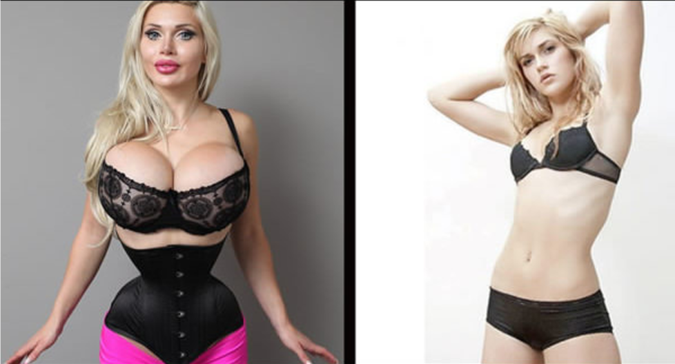 Nguoi mau bien dang sau khi phau thuat tham my hon 100 lan hinh anh