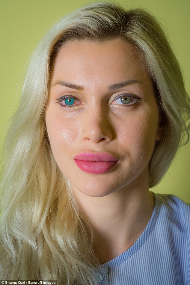 nguoi mau bien dang sau phau thuat tham my anh 2