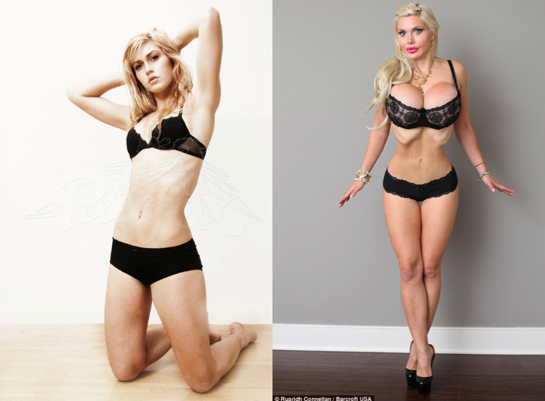 nguoi mau bien dang sau phau thuat tham my anh 3