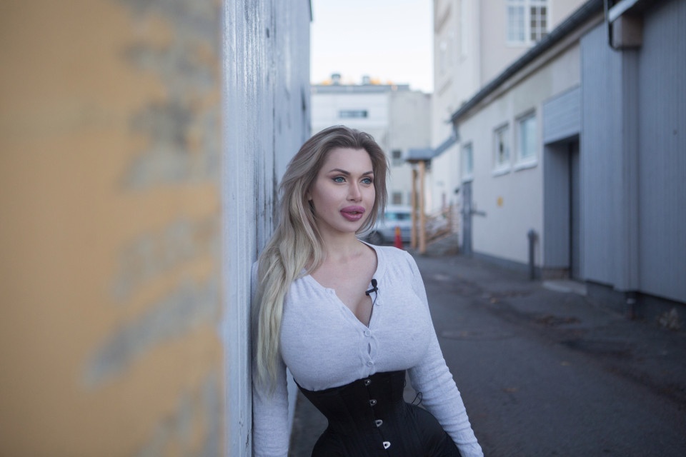 nguoi mau bien dang sau phau thuat tham my anh 7