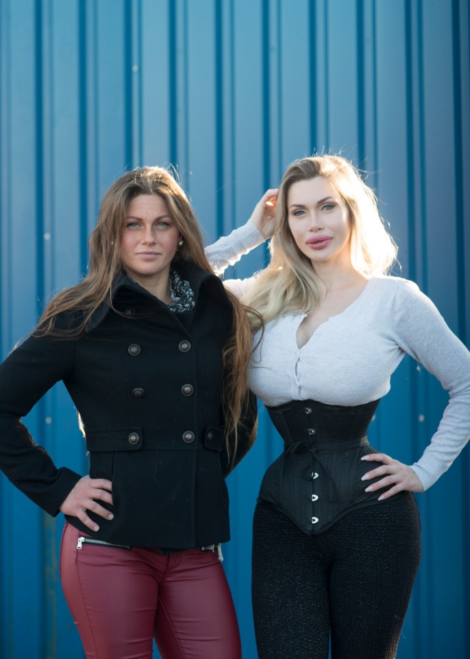 nguoi mau bien dang sau phau thuat tham my anh 9