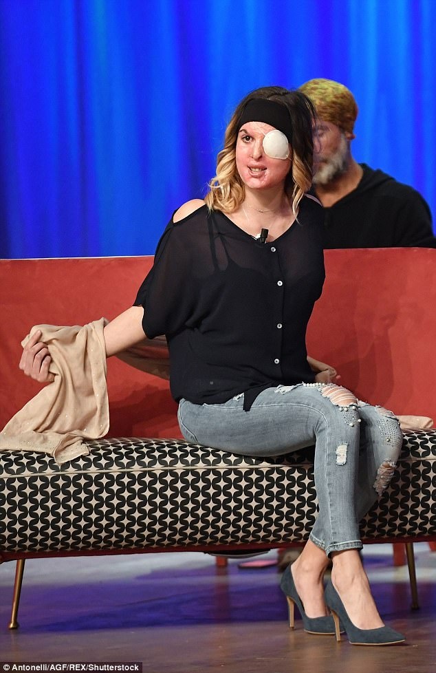 Người mẫu bị bạn trai cũ tạt axit ảnh 2 Nguoi mau bi ban trai cu tat axit anh 2