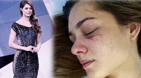 Hoa hau Trai Dat Venezuela bi nu ca si danh den nhap vien hinh anh