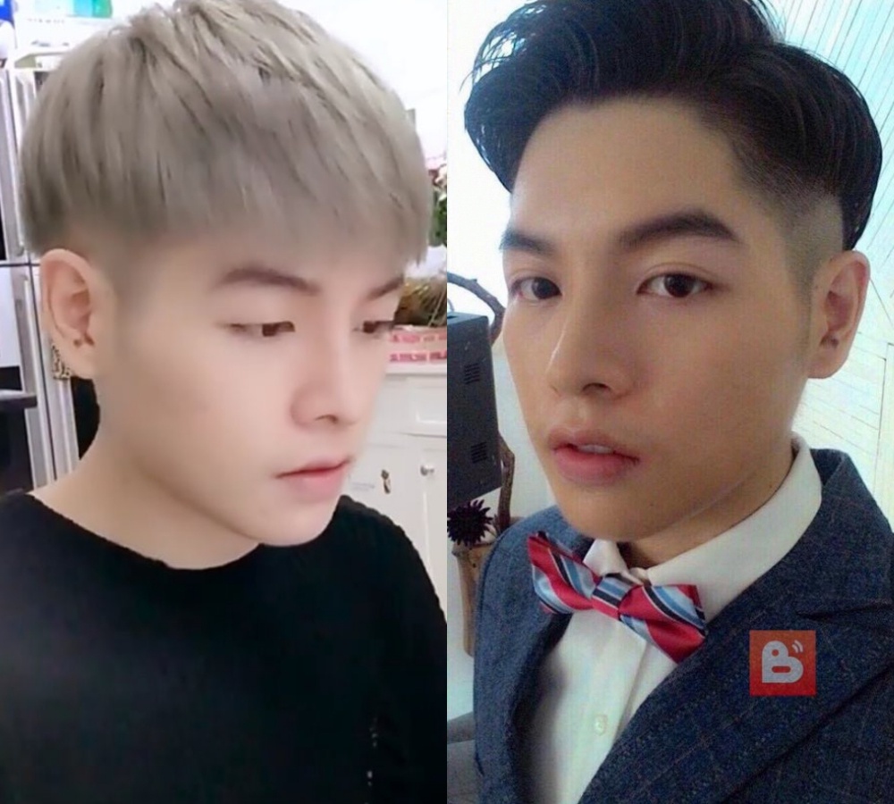 Duc Phuc phau thuat tham my anh 2