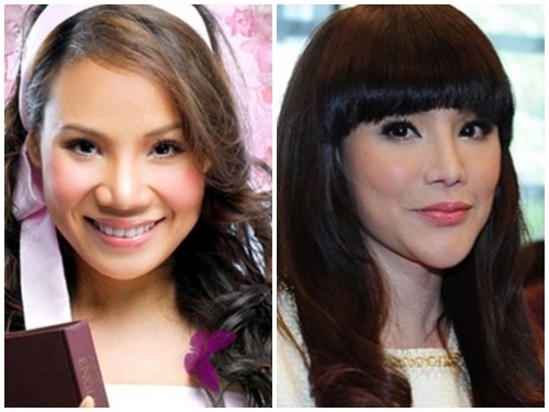 duc phuc phau thuat tham my anh 5