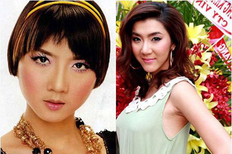 duc phuc phau thuat tham my anh 6