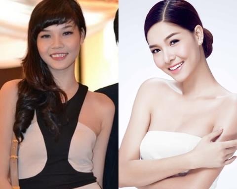 duc phuc phau thuat tham my anh 4