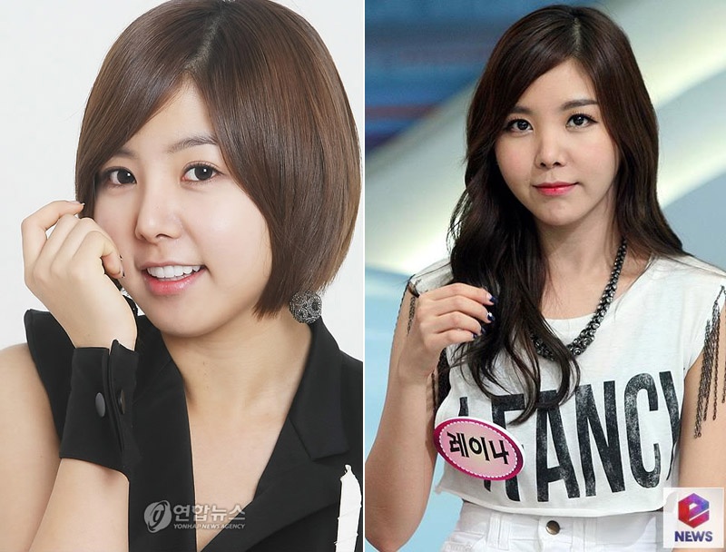 Nu ca si Han bi nghi sua mui bi lech anh 4