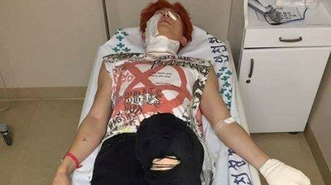 Thanh vien nhom nhac Han bong do 2 khi dang quay MV hinh anh