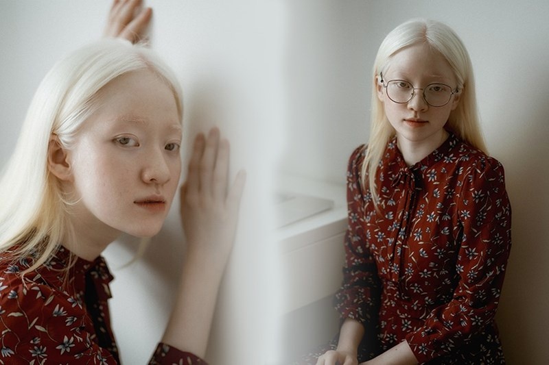 Nguoi mau bach tang buoc qua dinh kien de toa sang hinh anh