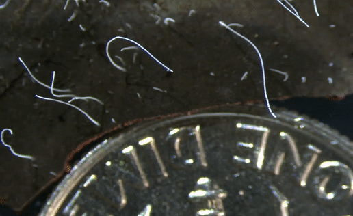 Phat hien vi khuan to gap 5.000 lan so voi binh thuong hinh anh