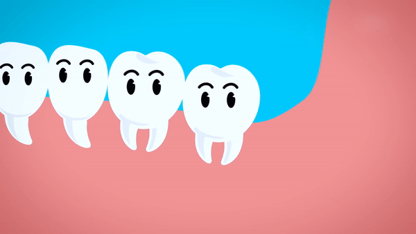 Vi sao rang khon thuong moc lech? hinh anh