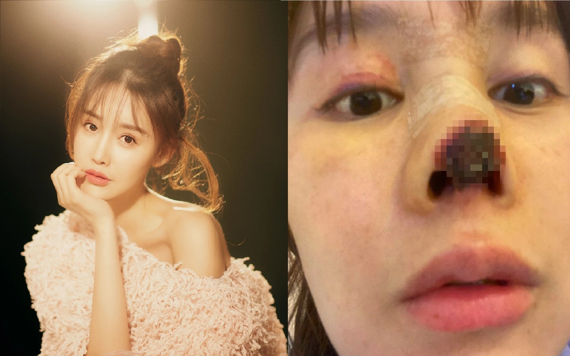 Muon kieu tham my khien khach hang hong mui, hoai tu bung hinh anh