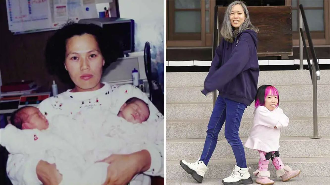 Cap song sinh co chieu cao chenh lech dat ky luc the gioi hinh anh