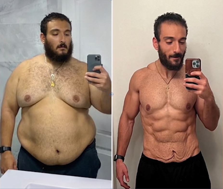 Chang trai giam hon 80 kg trong 2 nam hinh anh
