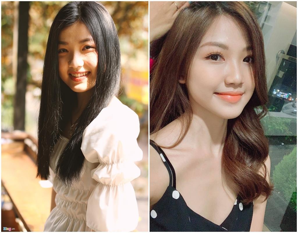 Lương Thanh phẫu thuật thẩm mỹ ảnh 1 Luong Thanh phau thuat tham my anh 1