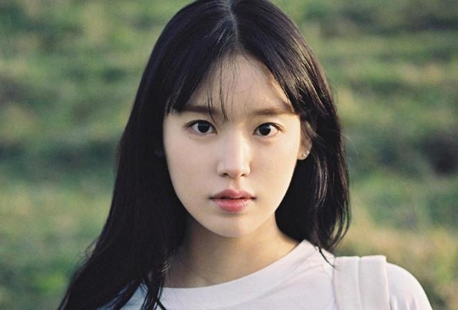 My nhan ‘Hau due mat troi’ - lam me o tuoi 21, bi chong bao hanh hinh anh