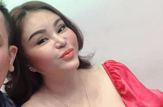 Le Giang bi nhan xet mat cung do, sung phu sau nhieu lan tham my hinh anh