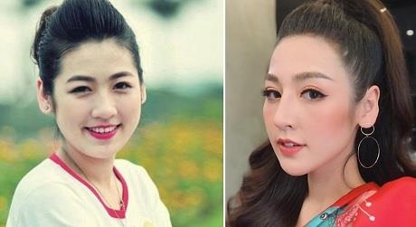 A hau Tu Anh vuong nghi van phau thuat tham my hinh anh