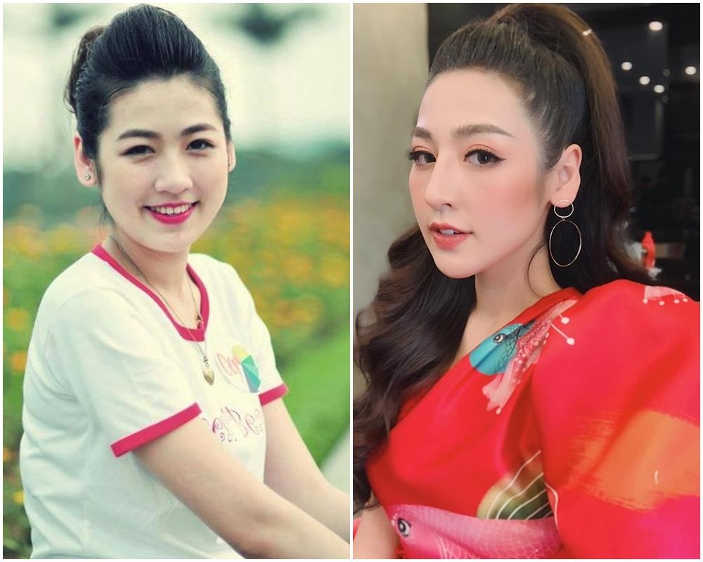 tú anh dính nghi án phẫu thuật thẩm mỹ ảnh 1 tu anh dinh nghi an phau thuat tham my anh 1