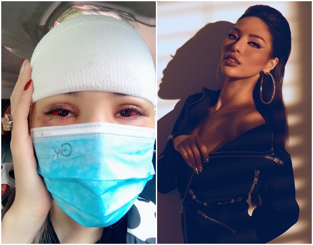 siêu mẫu khả trang bị tai nạn ảnh 1 sieu mau kha trang bi tai nan anh 1