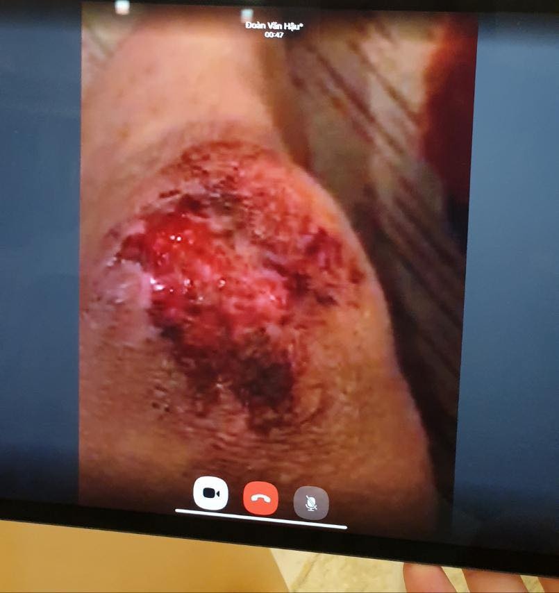 quang le goi van hau anh 2