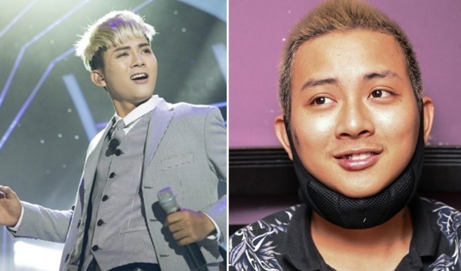 5 quan quan Guong mat than quen thay doi nhu the nao? hinh anh