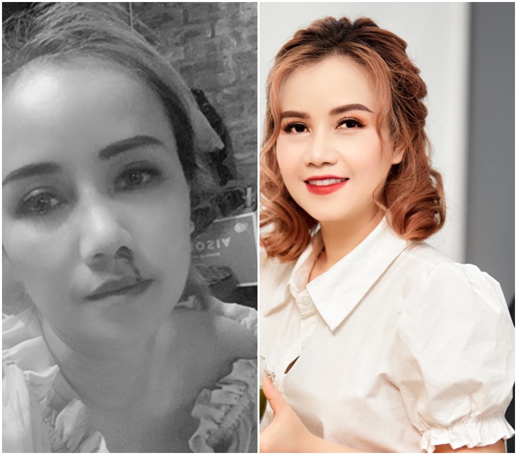 sao viet bi chong hanh hung anh 1