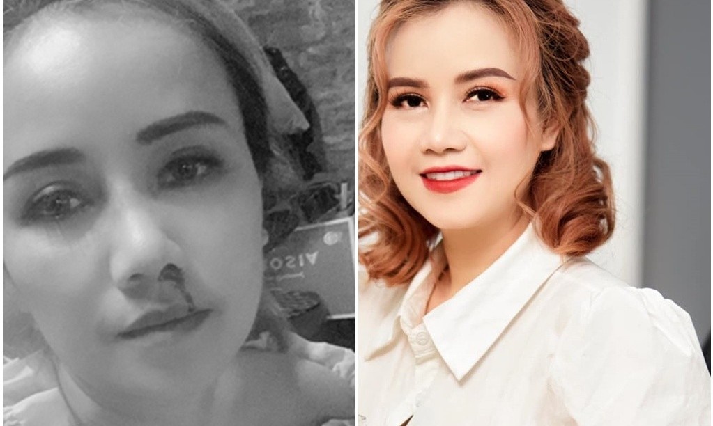 Bi kich bi chong bao hanh cua nhieu sao Viet hinh anh