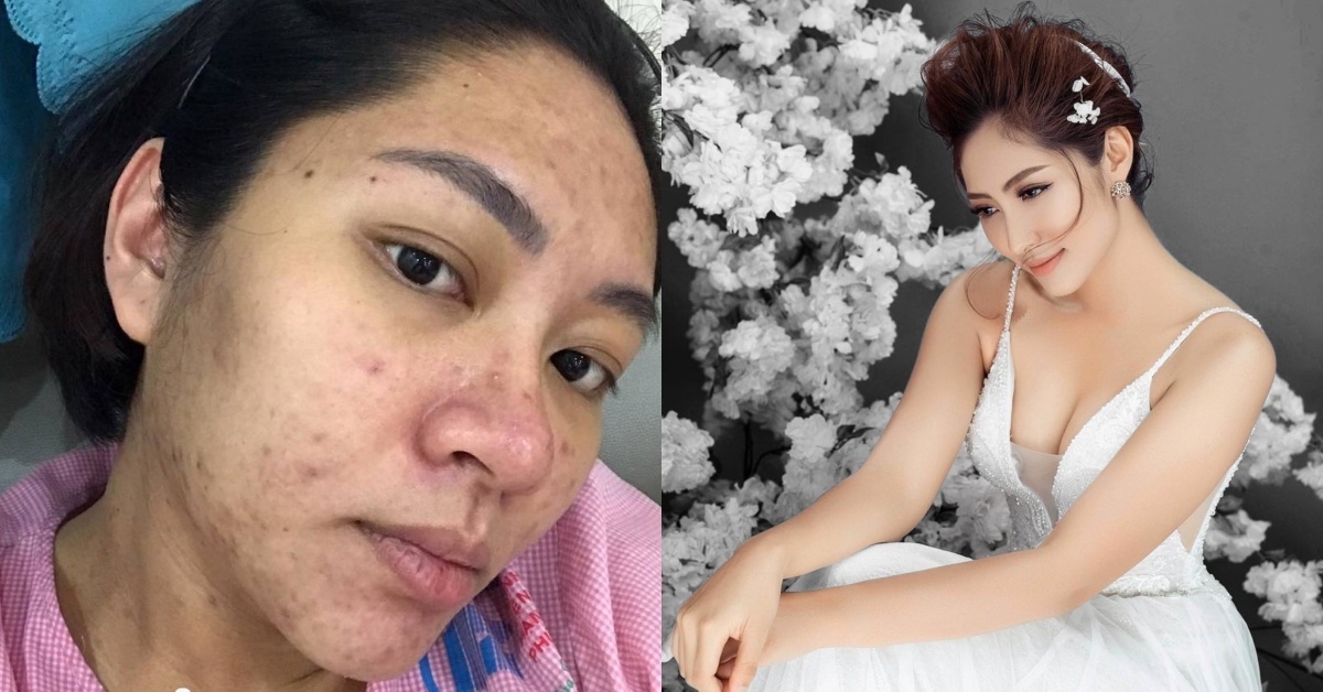 dan truong ly hon anh 3