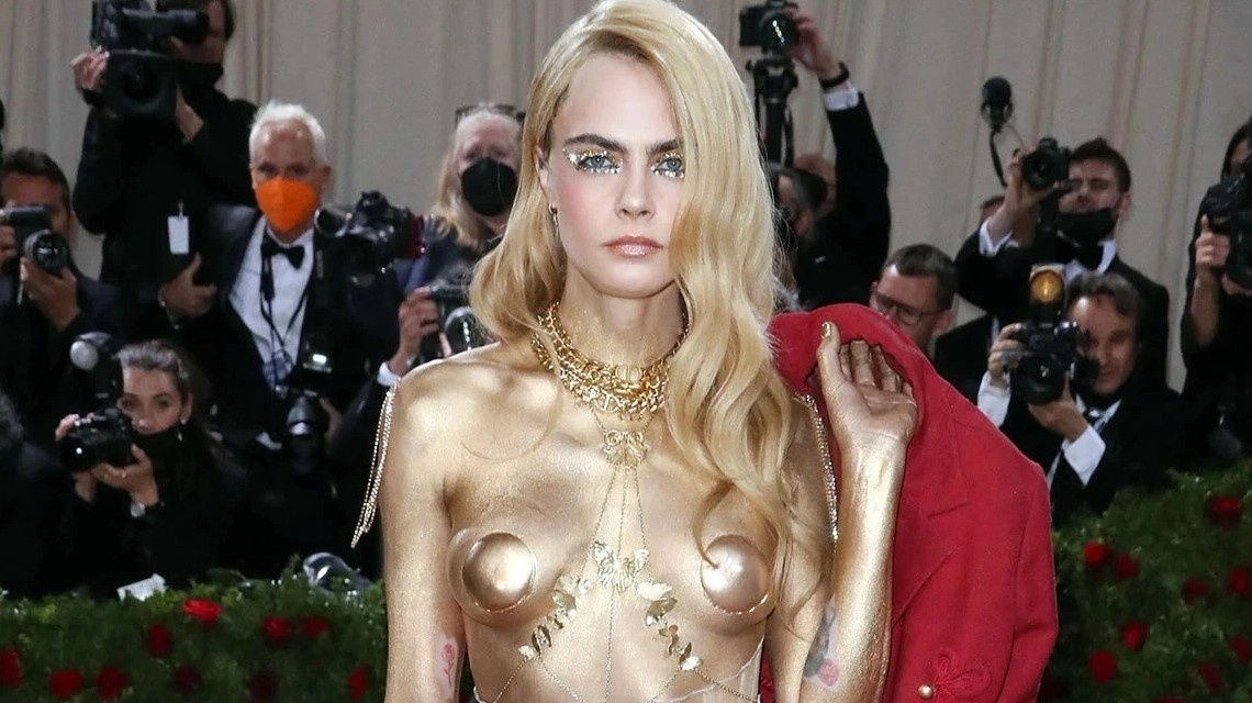 Sieu mau Cara Delevingne bi bong troc da vi benh vay nen hinh anh