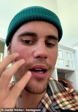 Justin Bieber dieu tri benh anh 2