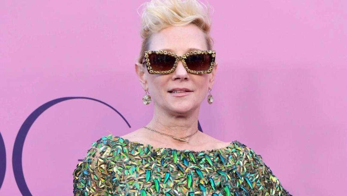 Dien vien My nguy kich sau khi oto boc chay hinh anh