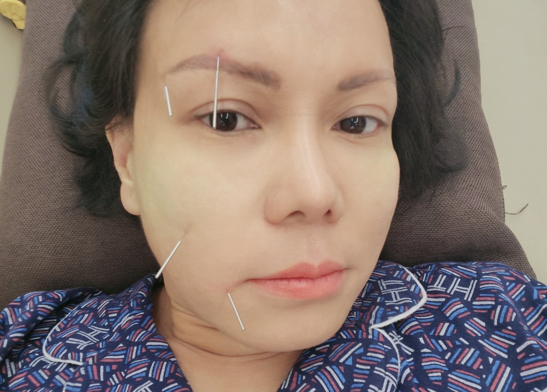 Viet Huong bi meo mat, phai cham cuu hinh anh