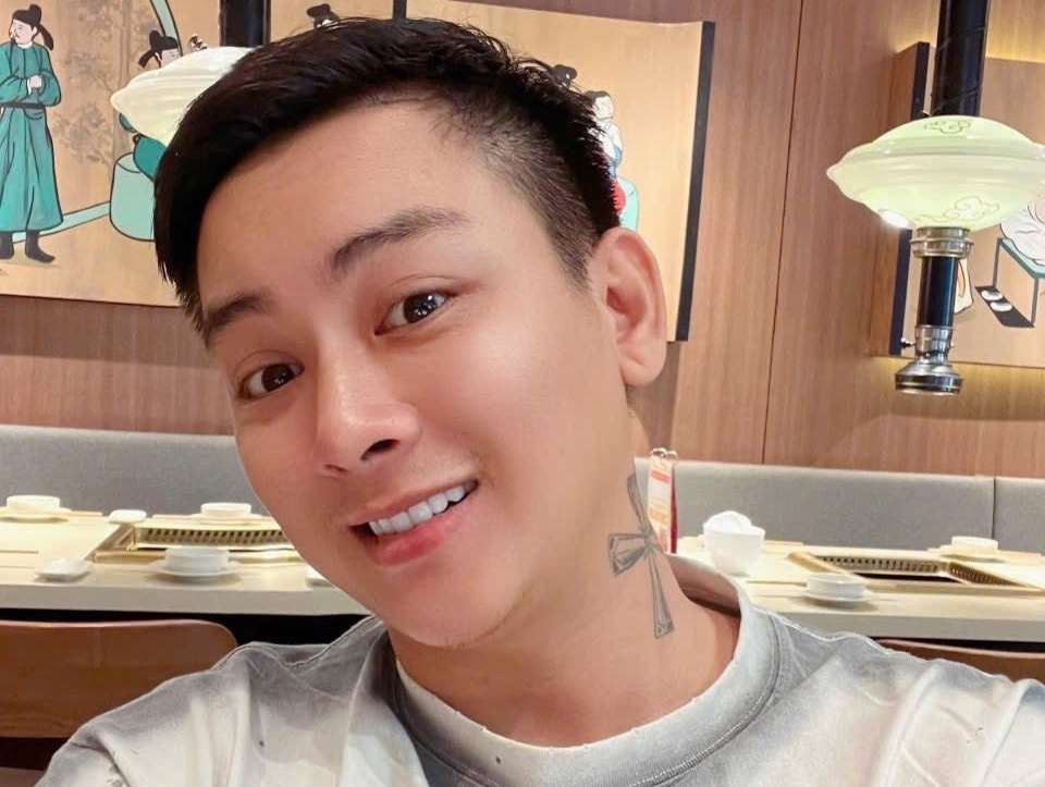 Tu Hoai Lam xoa xam, bac si luu y rui ro khi xam va xoa hinh hinh anh