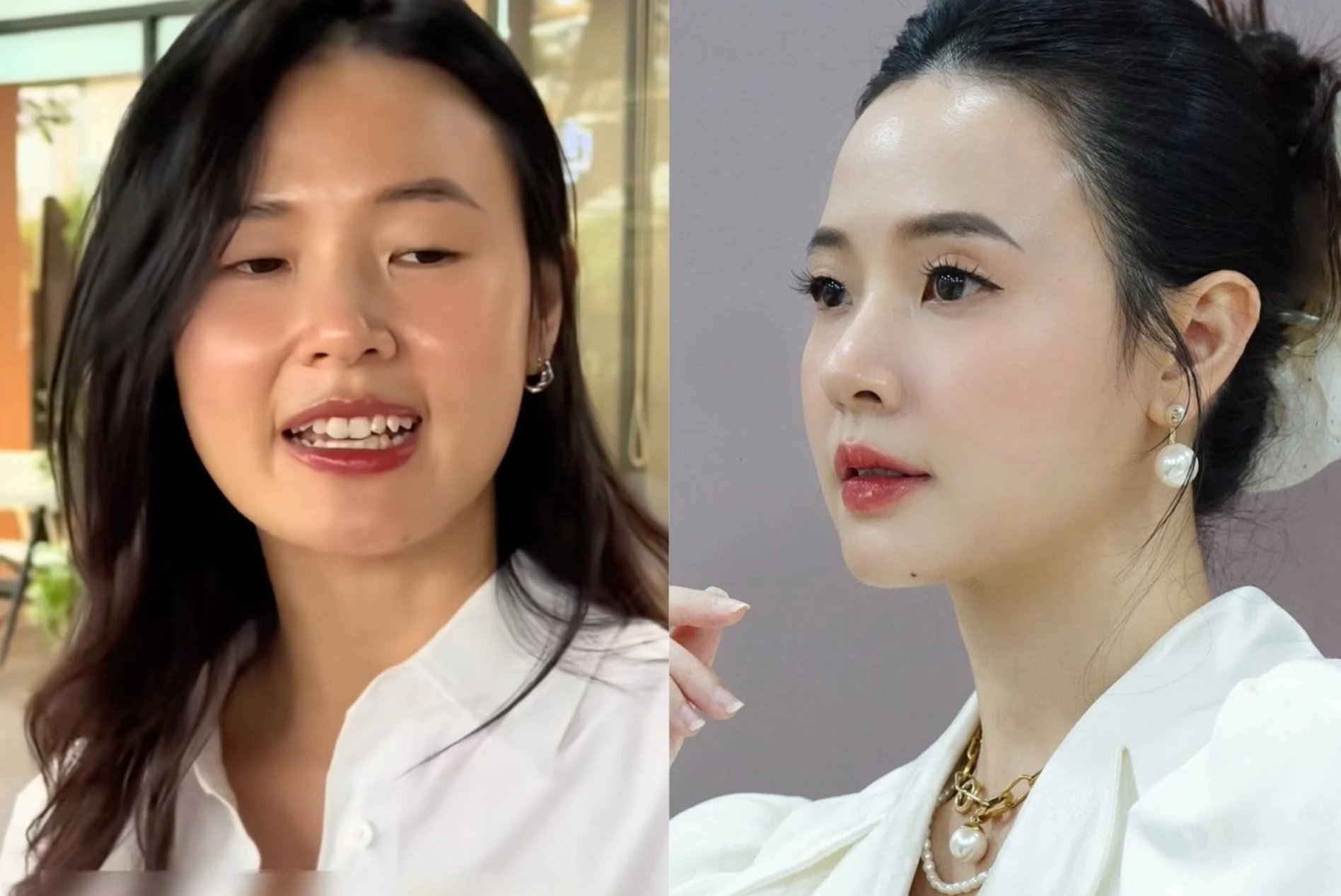 Anh doi thuong cua Midu hinh anh