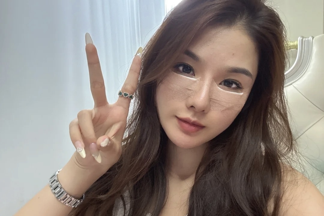 Nguoi tre My chi 5.000 USD de xoa bong mat hinh anh