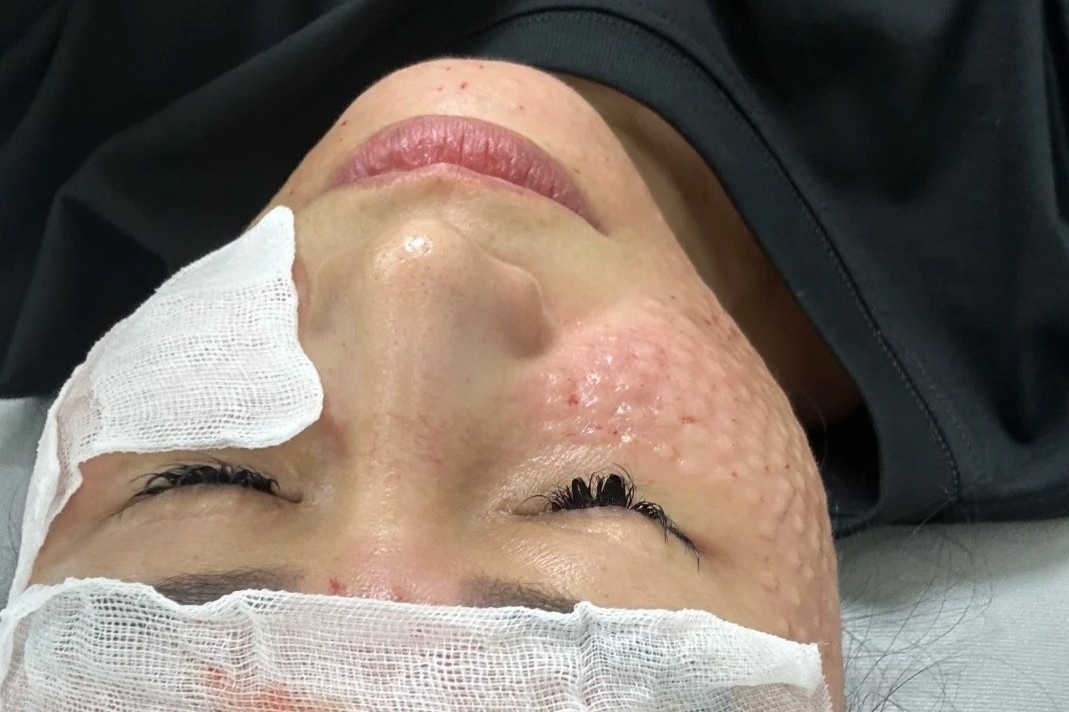 Bay hon 11.000 km sang Han Quoc de 'dam kim lien tiep' vao mat hinh anh