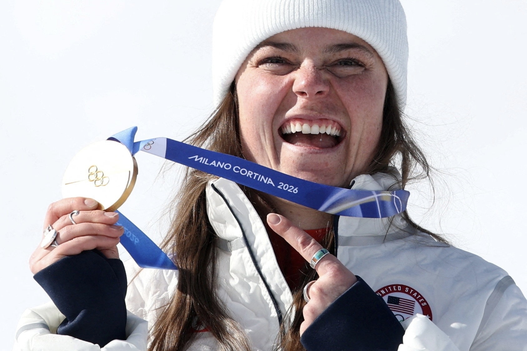 Can canh HCV Olympic bi gay nut ngay sau khi trao giai hinh anh