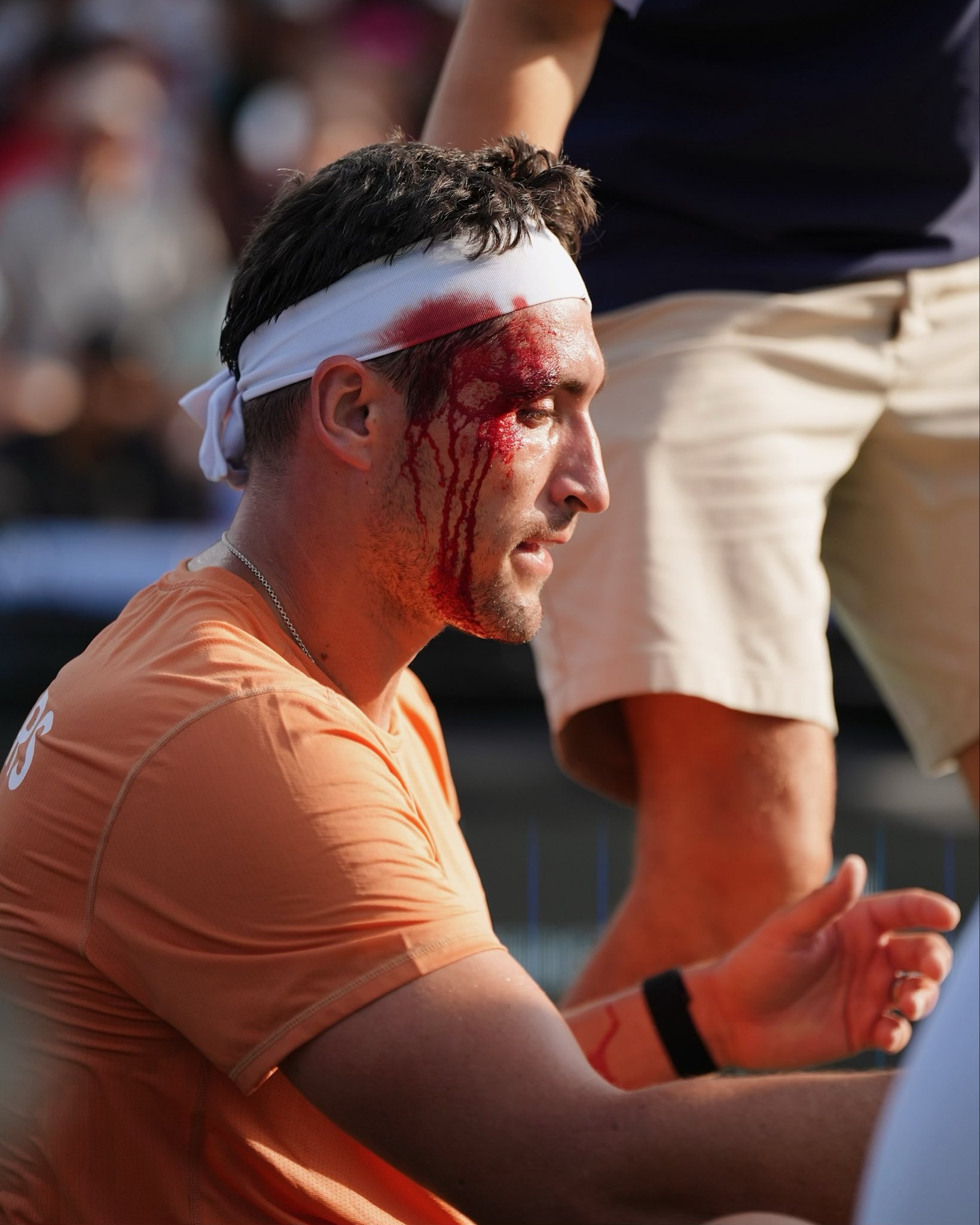 pickleball,  Jay Devilliers,  PPA,  MLP,  Jessie Irvine ảnh 1