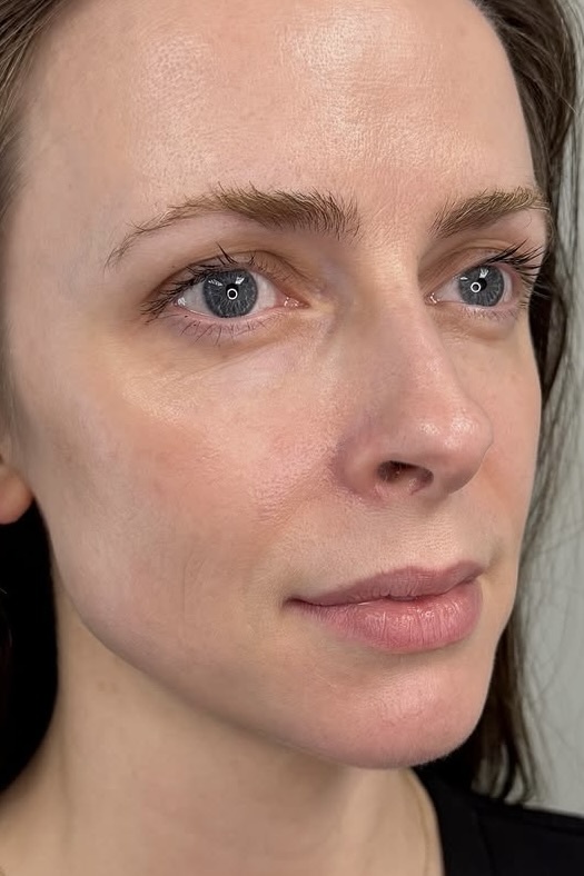 thẩm mỹ, 100, trẻ, chuyên viên, botox, filler, collagen ảnh 2 thẩm mỹ, 100, trẻ, chuyên viên, botox, filler, collagen ảnh 2
