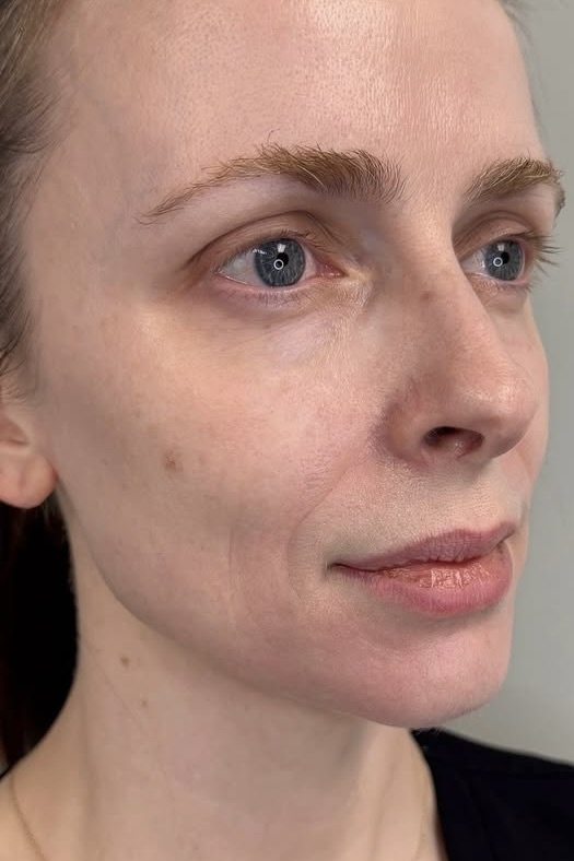 thẩm mỹ, 100, trẻ, chuyên viên, botox, filler, collagen ảnh 1 thẩm mỹ, 100, trẻ, chuyên viên, botox, filler, collagen ảnh 1