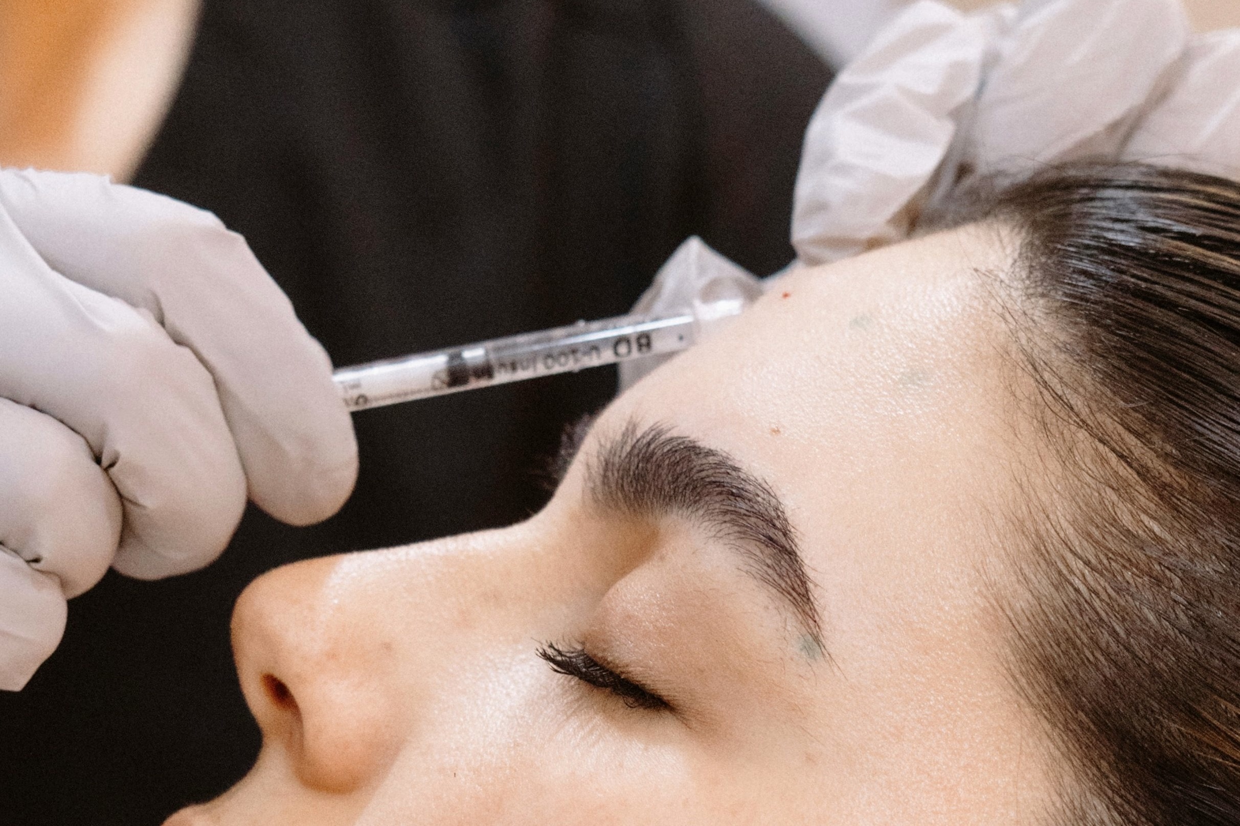 botox,  ti&ecirc;m,  buồn,  cảm x&uacute;c ảnh 1