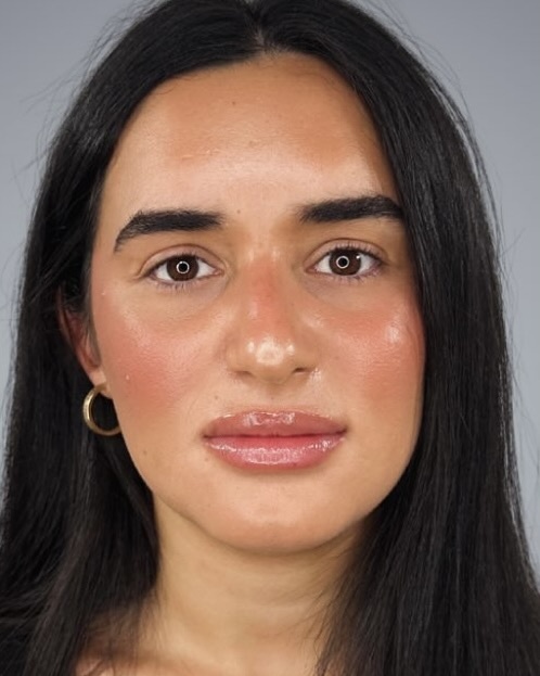 mắt, đổi màu, xanh, Keratopigmentation, thị lực, màu mắt ảnh 1 mắt, đổi màu, xanh, Keratopigmentation, thị lực, màu mắt ảnh 1
