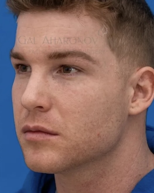 mắt,  Looksmaxxing,  hunter eyes  ảnh 2