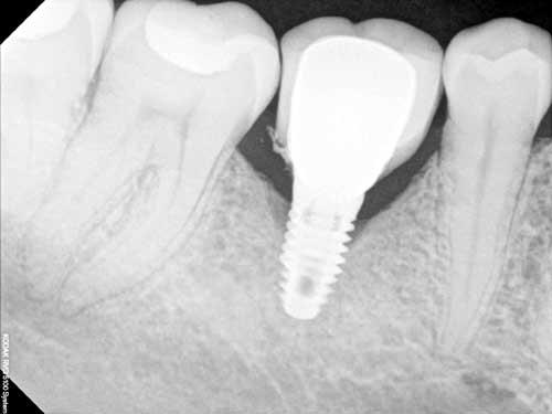 Tim hieu ve X-quang trong nha khoa hinh anh