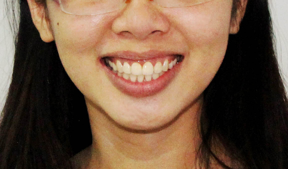 Trang cùng hàm răng mới đều tăm tắp.